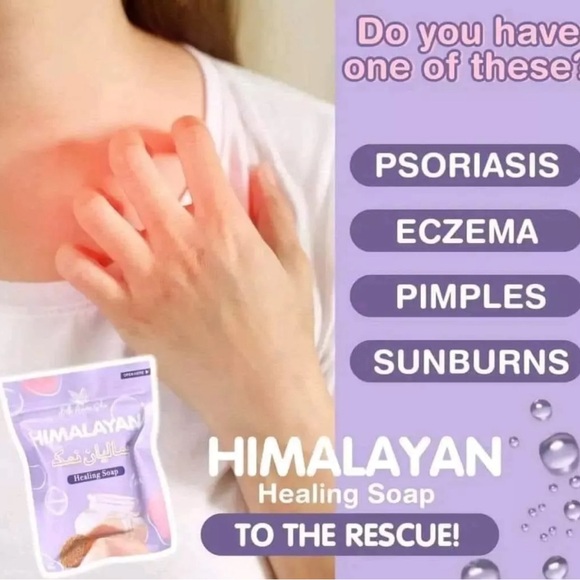 2x Himalayan Healing & Brightening Soap by Bella Amore Skin (130g) - Picture 4 of 7